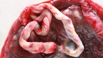 placenta_istock_000007419276small-352x198.jpg