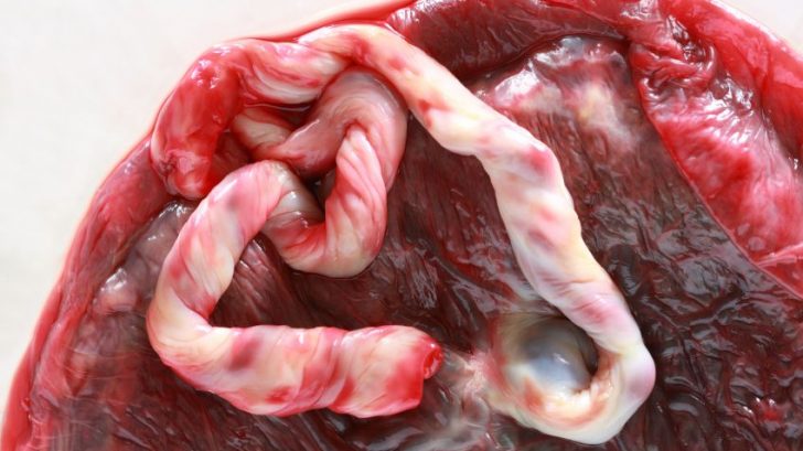 placenta_istock_000007419276small-728x409.jpg