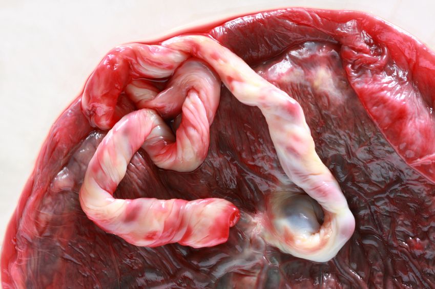 placenta_istock_000007419276small.jpg