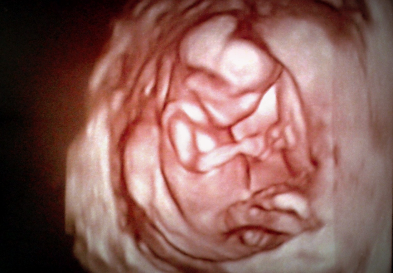 Fotografie (13 týždeň tehotenstva – koniec prvého trimestra)